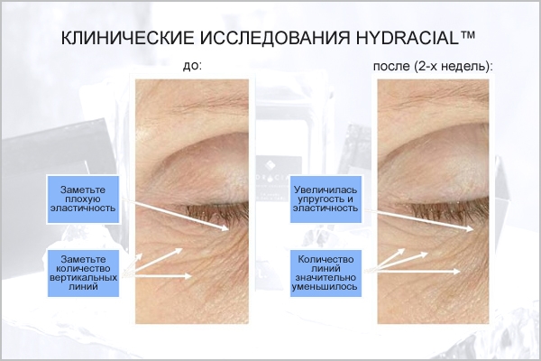 Клинические исследования анитвозрасной системы по уходу за кожей Hydracial