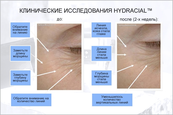 Клинические исследования анитвозрасной системы по уходу за кожей Hydracial